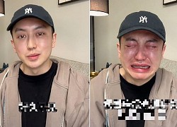 Kim Đại Uy, Tôn Phi Phi và loạt sao chịu hậu quả vì thẩm mỹ