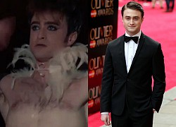 &#8220;Harry Potter&#8221; Daniel Radcliffe bung xõa táo bạo &#8220;phơi bày&#8221; vòng 3