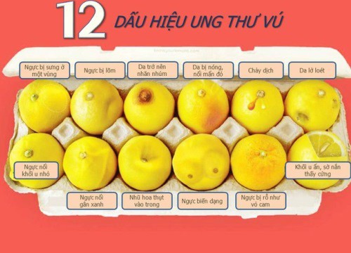 Phát hiện ung thư vú nhờ vào bức hình về 12 quả chanh