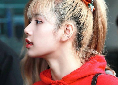 Chuyên gia tiết lộ tình trạng rụng tóc như mưa của idol Kpop, liệu nhuộm tẩy có gây hói hoàn toàn?