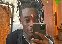 Lil Uzi Vert và viên kim cương 11 carat trên trán: Đi biểu diễn fan "vô tình" tháo giúp