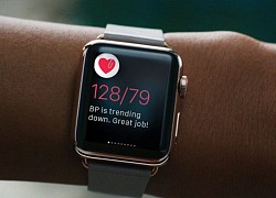 Loạt cảm biến sức khỏe mới có thể xuất hiện trên Apple Watch