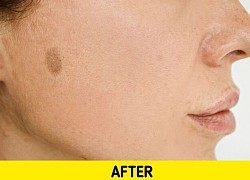 Skincare bằng nước vo gạo cho làn da trẻ đẹp