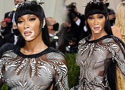 Siêu mẫu bạch biến Winnie Harlow thả rông trên thảm đỏ Met Gala 2021