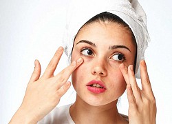 7 sai lầm skincare khiến mụn ngày càng mọc nhiều, làn da xuống cấp