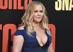 Amy Schumer phẫu thuật bỏ tử cung