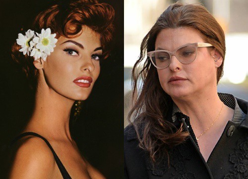 Siêu mẫu Linda Evangelista bị biến dạng cơ thể vì làm đẹp