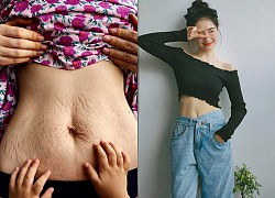 Mỹ nhân Vbiz tự yêu vết rạn da trên cơ thể: Hòa Minzy đầy tự tin