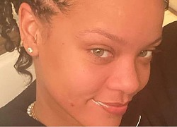 Rihanna không ngại tiết lộ các vấn đề về da