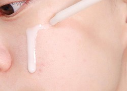 4 sản phẩm skincare chị em đừng "dại dột" dùng trước Tết, da sẽ xấu không kịp cứu vãn