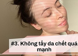 4 điều gái Pháp tránh tuyệt đối để hạn chế môi khô nứt nẻ vào mùa Đông