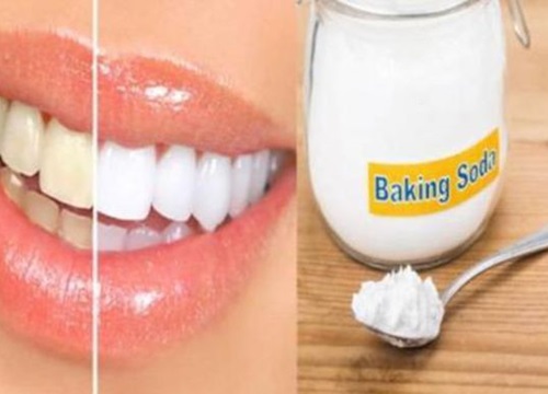 Chuyên gia tư vấn: Dùng Baking soda làm trắng răng và chăm sóc răng miệng- Những lầm tưởng tai hại