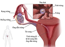 13 dấu hiệu mang thai sớm và những lời khuyên hữu ích