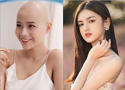 Vụ cô gái ung thư thi Miss World Việt Nam: Ekip xin lỗi vì ghi nhầm danh hiệu, động thái "Hoa khôi real" gây chú ý