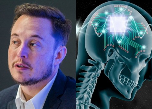 Công ty của Elon Musk chuẩn bị cấy ghép chip vào não người để "chế tạo" siêu nhân