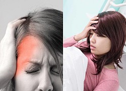 Đau nửa đầu hay bệnh Migraine