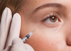 Tác hại tiềm ẩn khi 20 tuổi đã tiêm botox