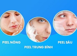 Những lưu ý đặc biệt khi thực hiện peel da tại nhà