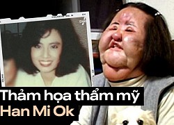 "Thảm họa thẩm mỹ" xứ Hàn: Nữ ca sĩ 17 lần phẫu thuật cứu vãn nhan sắc vì tự tiêm dầu ăn và qua đời bí ẩn tuổi 57