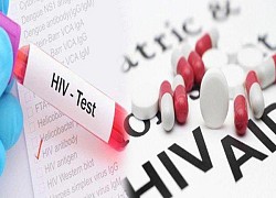 HIV tăng nhanh trong giới trẻ, tăng cường truyền thông thay đổi hành vi