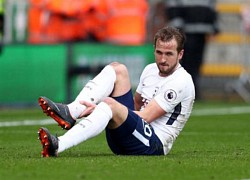 Harry Kane để lộ mắt cá chân bất thường