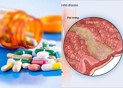 Các thuốc dùng điều trị bệnh Crohn