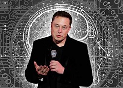 Elon Musk sẽ cấy chip Neuralink