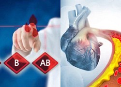 Phát hiện nhóm máu dễ bị cholesterol cao nguy hiểm