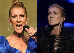 Celine Dion mắc bệnh hiếm gặp không thể chữa khỏi