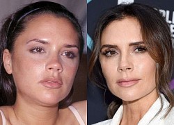 Victoria Beckham lên tiếng về tin đồn sửa mũi