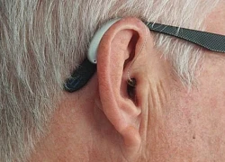 Sinh viên y cấy thiết bị bluetooth vào tai để gian lận thi cử tại Ấn Độ