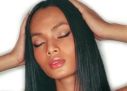 Người mẫu Châu Kim Sang: 2 năm 5 lần phẫu thuật, 4 lần mổ sọ