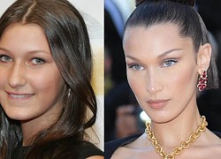 Bella Hadid thú nhận dao kéo 1 điểm từ năm 14 tuổi nhưng giờ nghĩ lại thì chỉ thấy hối hận vô vàn