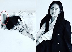 "Em gái quốc dân" Moon Geun Young lộ diện sau 4 cuộc phẫu thuật, xót xa vết thương kéo dài cả nửa cánh tay