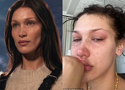 Siêu mẫu Bella Hadid gây sốc khi "dao kéo" từ năm 14 tuổi, từng bị trầm cảm tới mức ngủ dậy là khóc