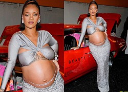 Rihanna lên đồ gợi cảm khoe bụng bầu, tạo dáng sang chảnh bên siêu xe