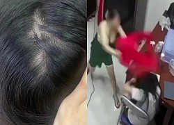 TP.HCM: Bé gái nghi bị mẹ ruột bạo hành dã man suốt 4 năm cùng lời nức nở "Mẹ đánh chết con đi, đánh chết con cũng được", dì ruột cầu cứu CĐM