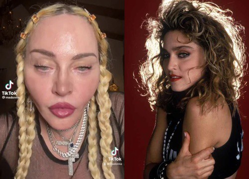 "Biểu tượng gợi cảm" Madonna khiến netizen phát hoảng với gương mặt biến dạng tới dọa người