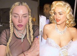 'Nữ hoàng nhạc Pop' Madonna gây sốc, xuất hiện với diện mạo đơ cứng khó tin