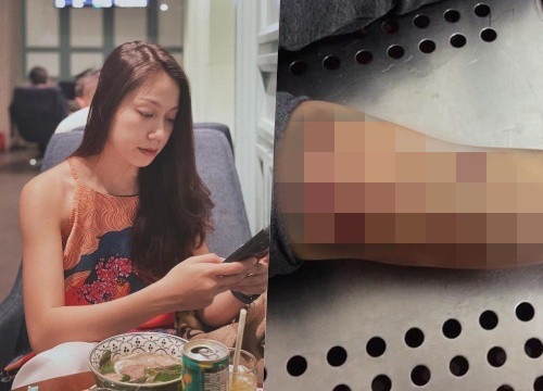 MỚI NHẤT: Kết luận giám định pháp y bổ sung vụ bé gái 8 tuổi bị "dì ghẻ" đánh không qua khỏi