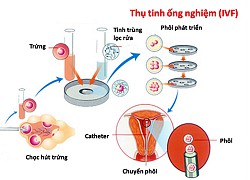 Thụ tinh nhân tạo và thụ tinh ống nghiệm: Giải pháp ưu việt cho người hiếm muộn