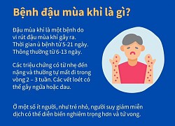 WHO lo ngại về ổ dịch đậu mùa khỉ bùng phát