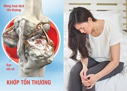 Xương khớp có thể 'già' sớm ở tuổi 30