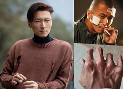 Tạ Đình Phong bị thương nặng
