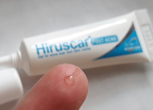 Kem trị sẹo thâm Hiruscar Post Acne có hiểu quả không?