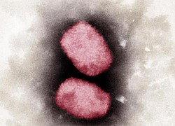 WHO: Không có bằng chứng cho thấy virus đậu mùa khỉ đã biến đổi