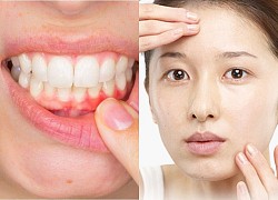 5 dấu hiệu trên mặt cảnh báo sức khỏe lá lách, dạ dày đang xấu đi từng ngày