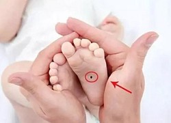 Người có 3 nốt ruồi trên bàn chân cực kỳ lộc lá, sớm muộn cũng giàu có