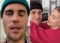 Hailey có hành động gây chỉ trích trong lúc Justin Bieber vật lộn với bệnh hiếm, liệt nửa mặt