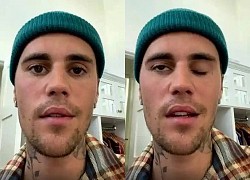 Justin Bieber bị liệt cơ mặt